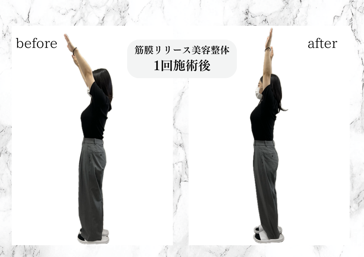 筋膜リリース美容整体