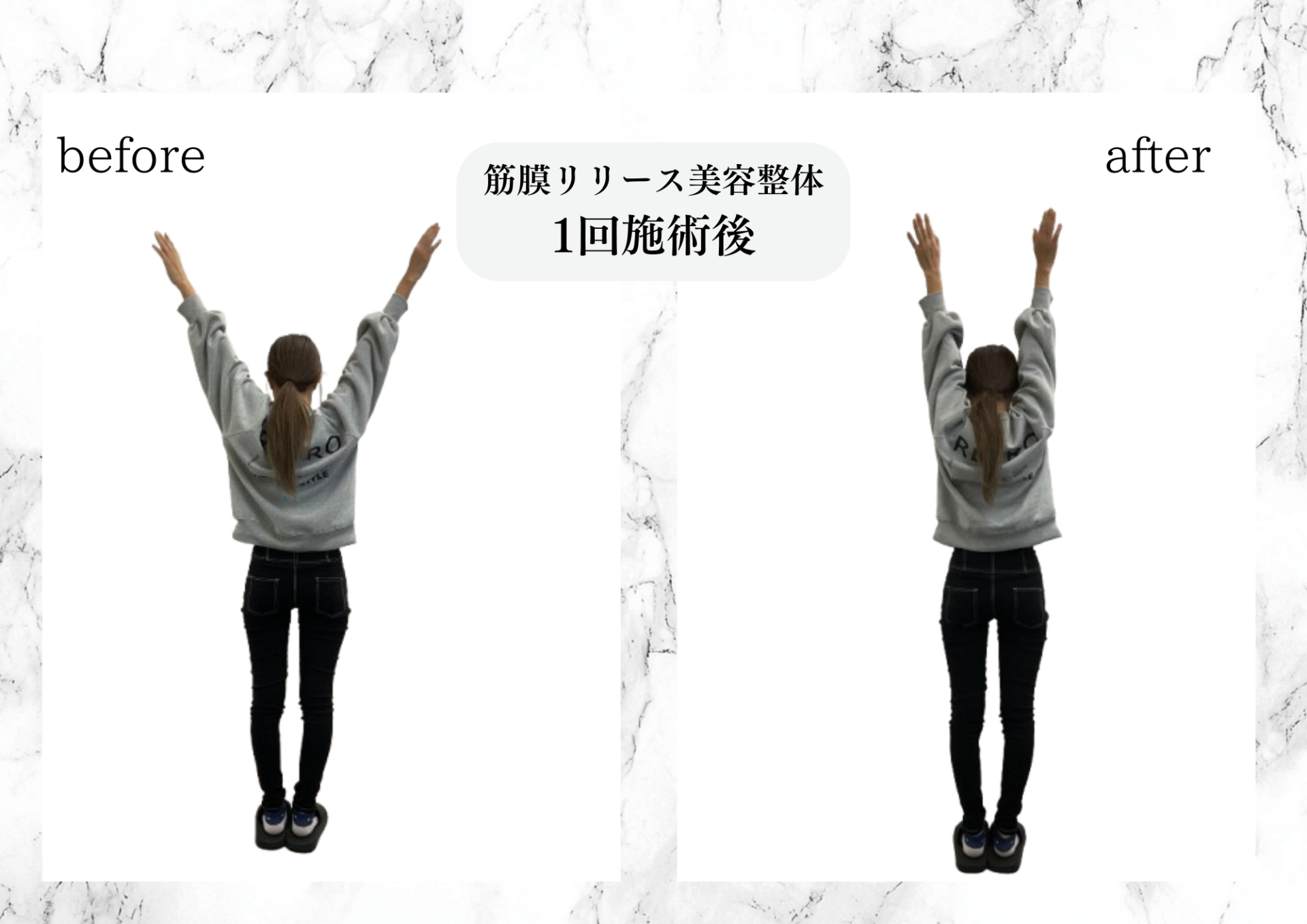 筋膜リリース美容整体