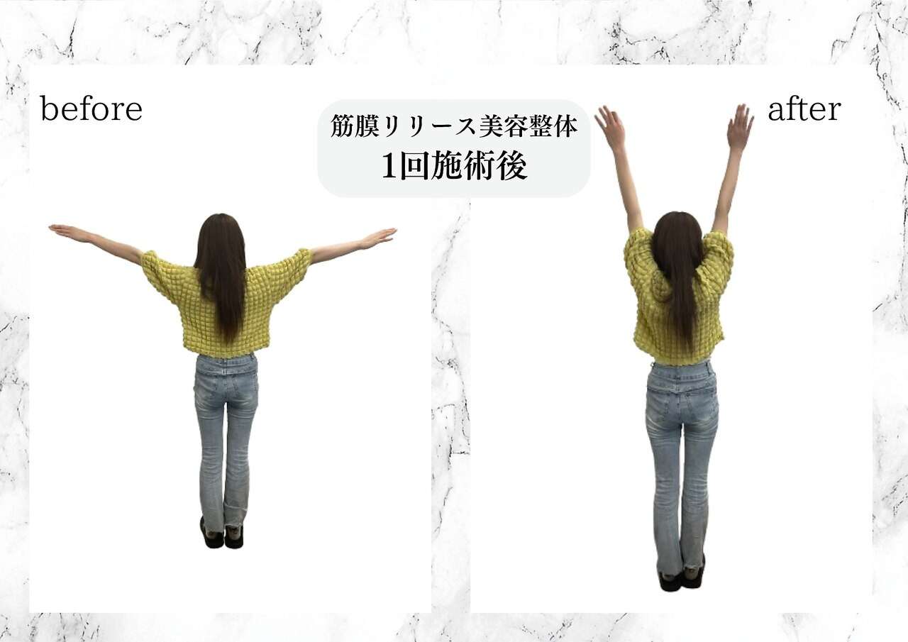 筋膜リリース美容整体　施術後