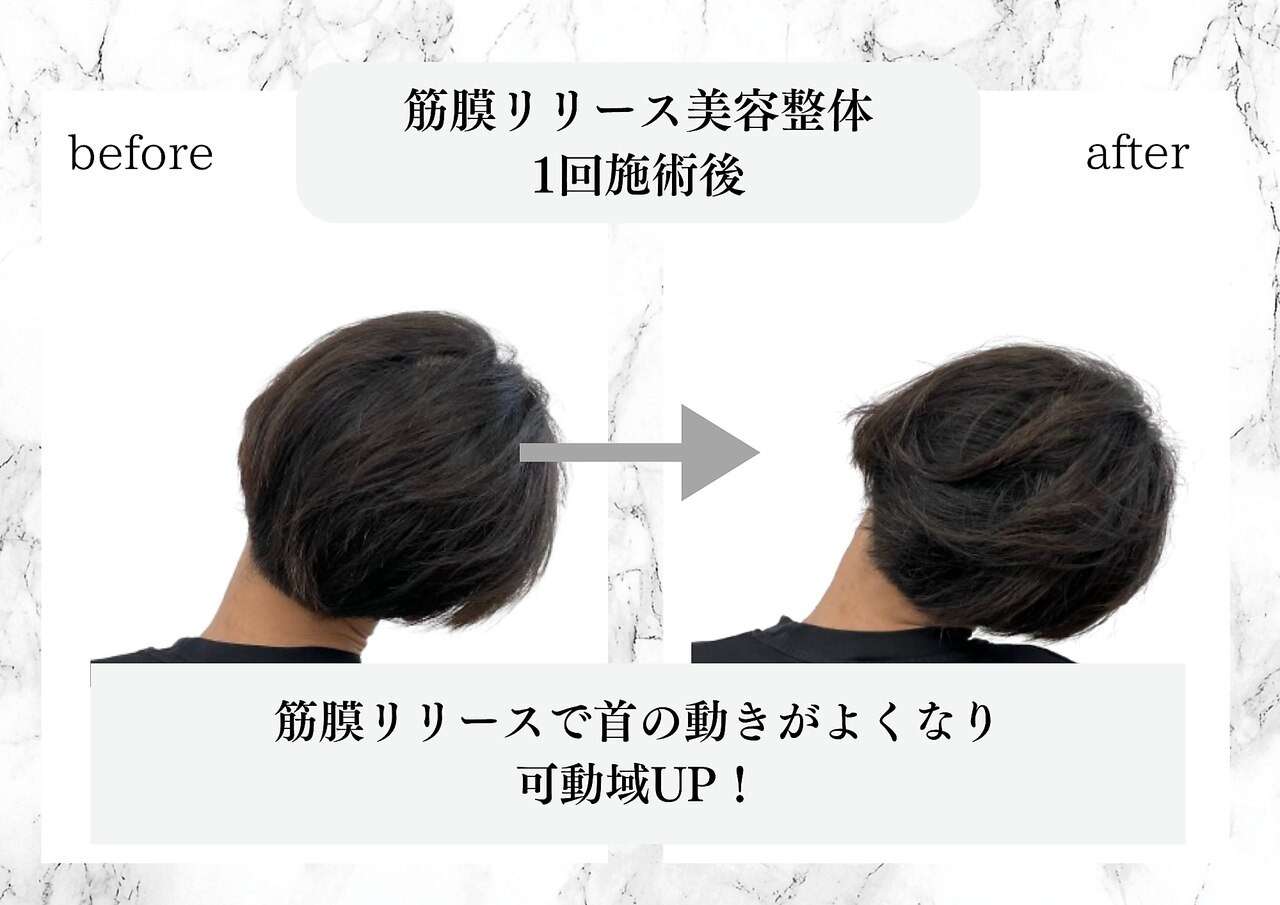 筋膜リリース美容整体　施術後